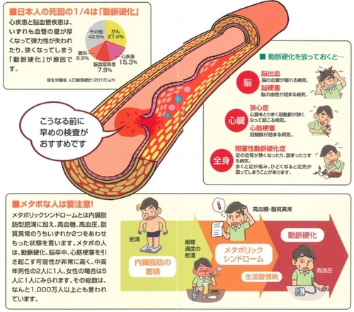 血管しなやかさ検査 動脈硬化検査 三重県松阪市 花の丘病院 健康管理施設アニモ